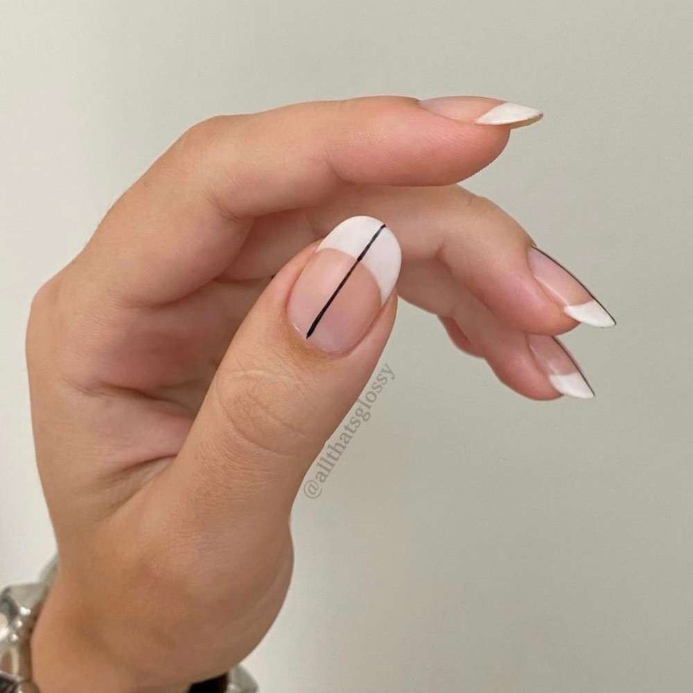 Dark lines in nails | MDedge Family Medicine